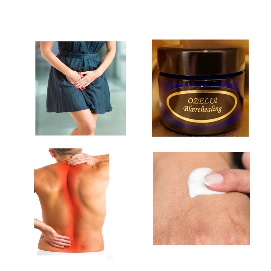 Ozelia Blærehealing