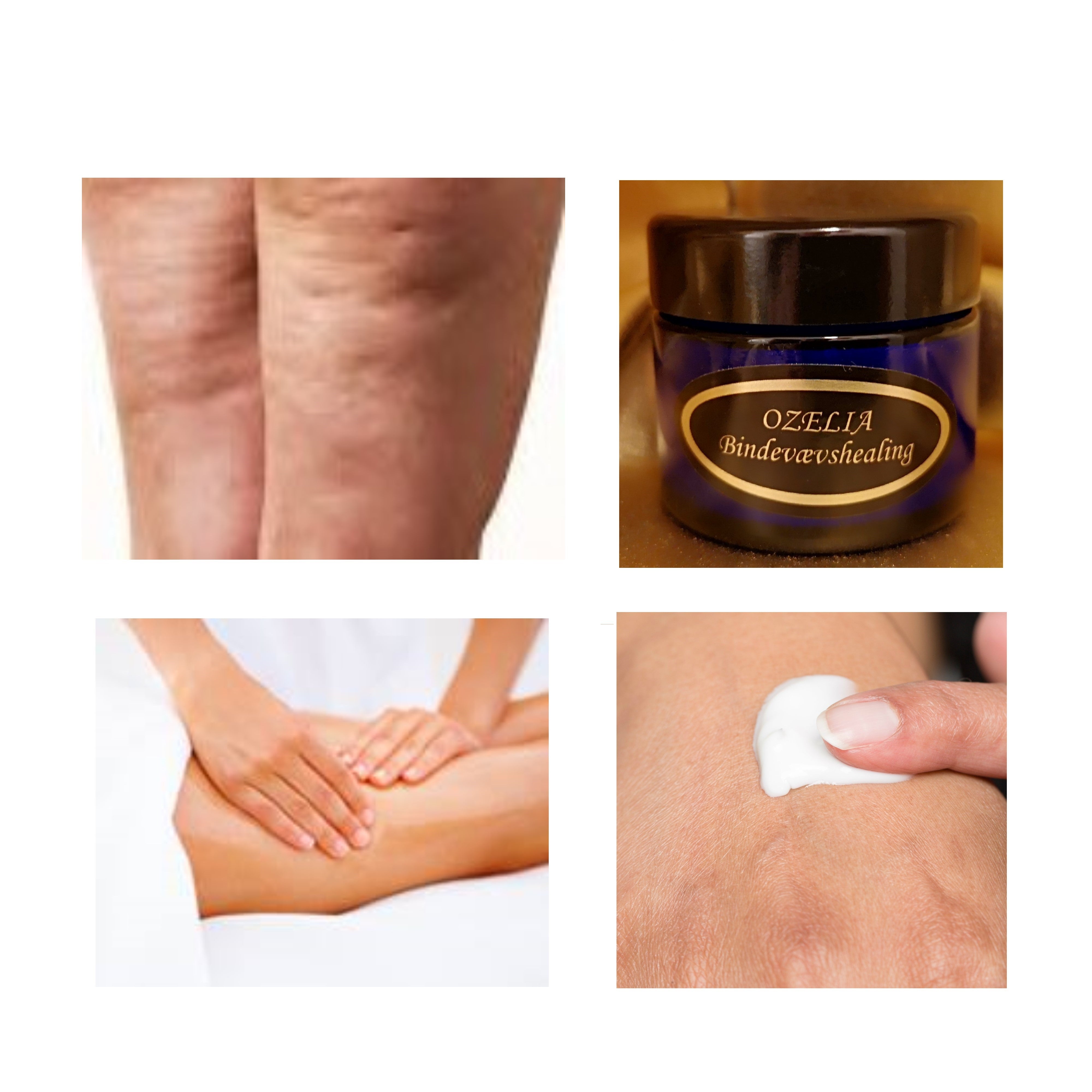 Ozelia Connective Tissue Healing