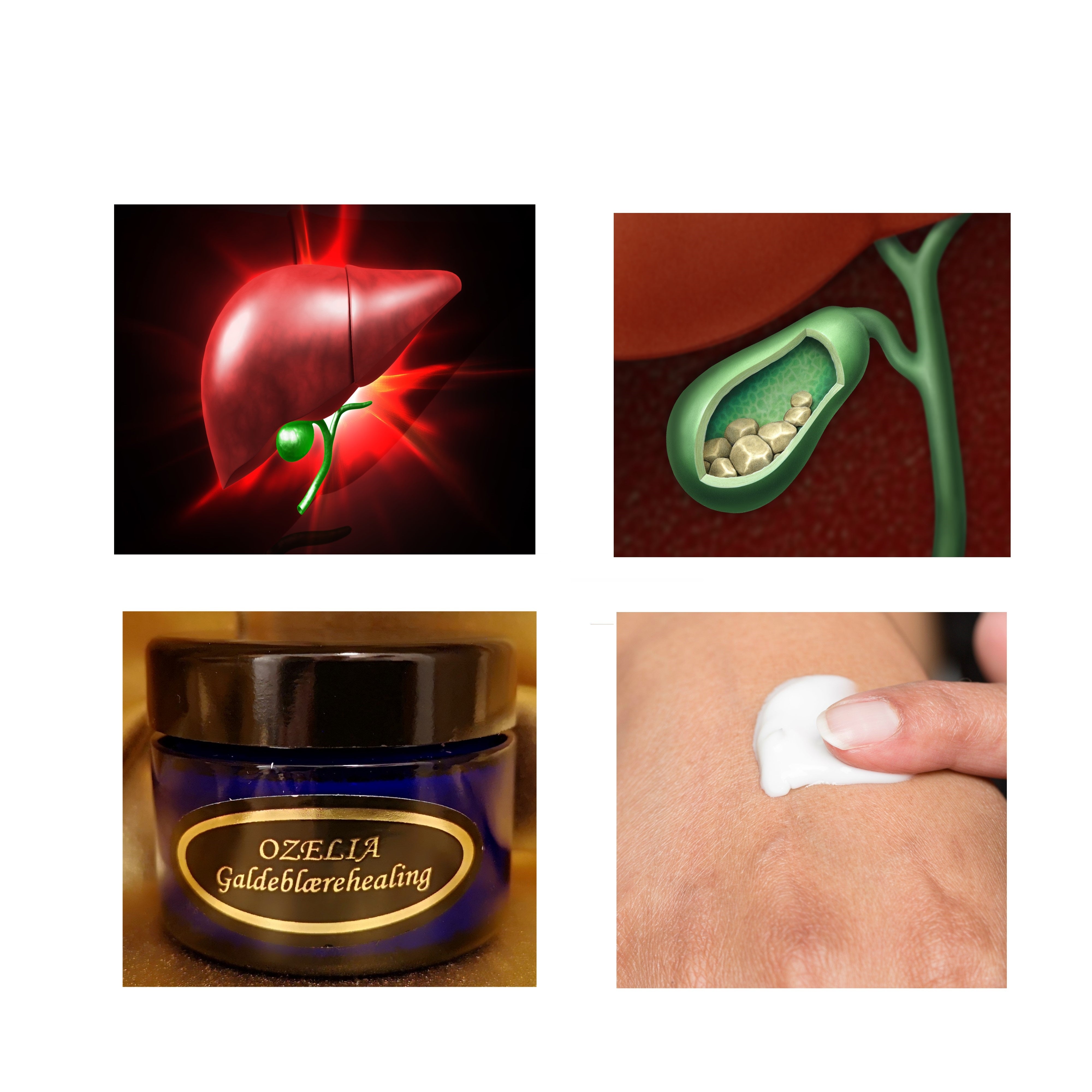 Ozelia Galdeblærehealing