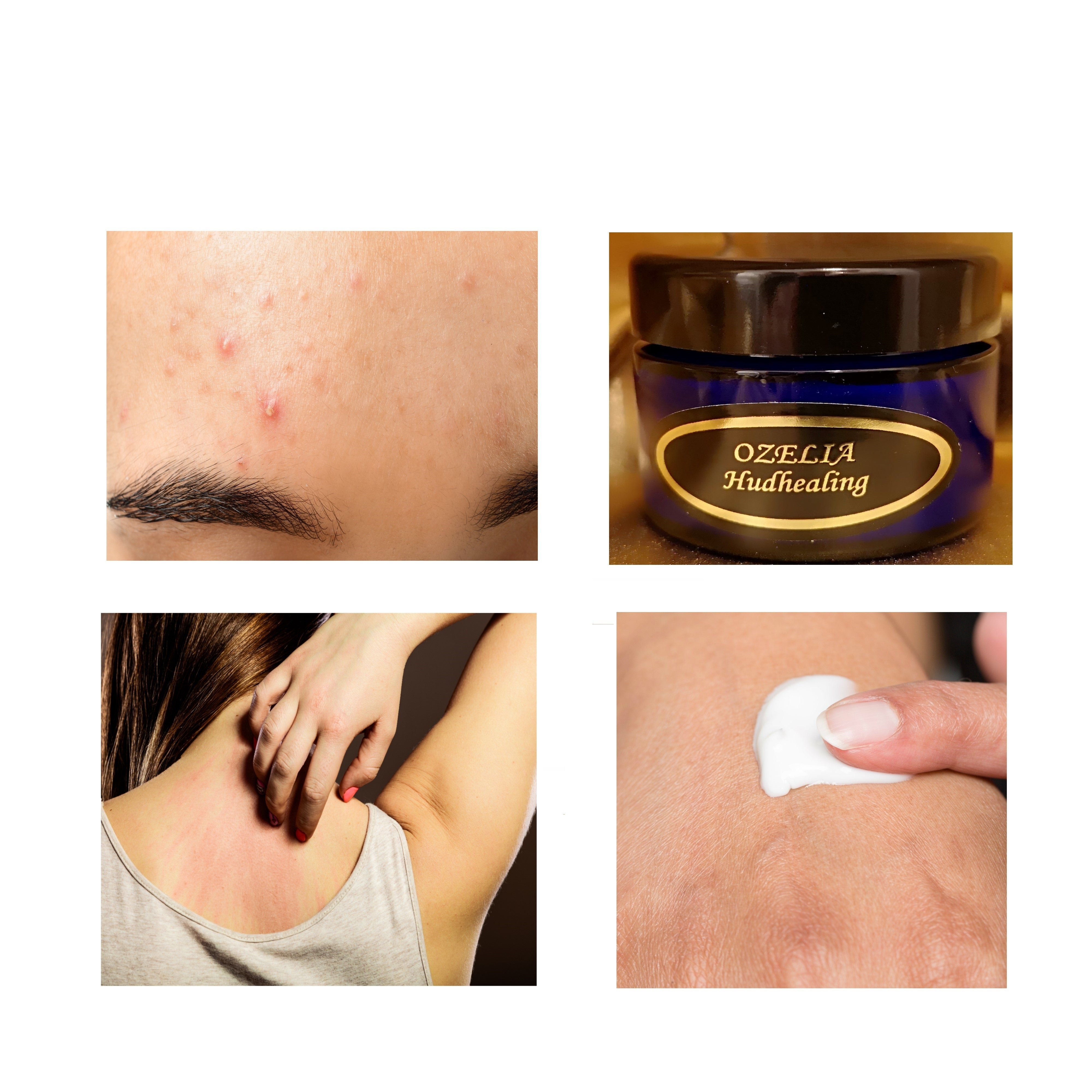 Ozelia Skin Healing