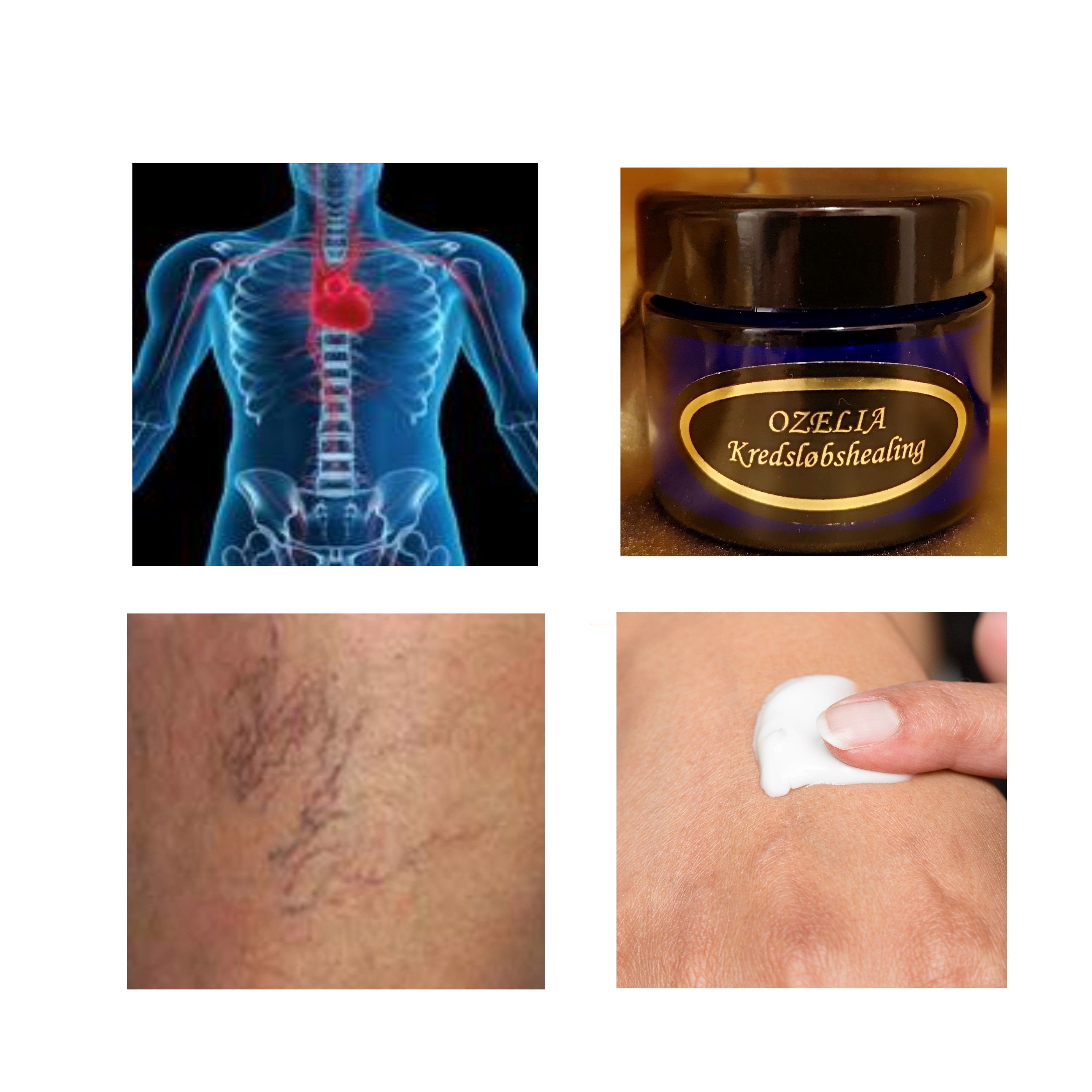 Ozelia Blood Circulation Healing