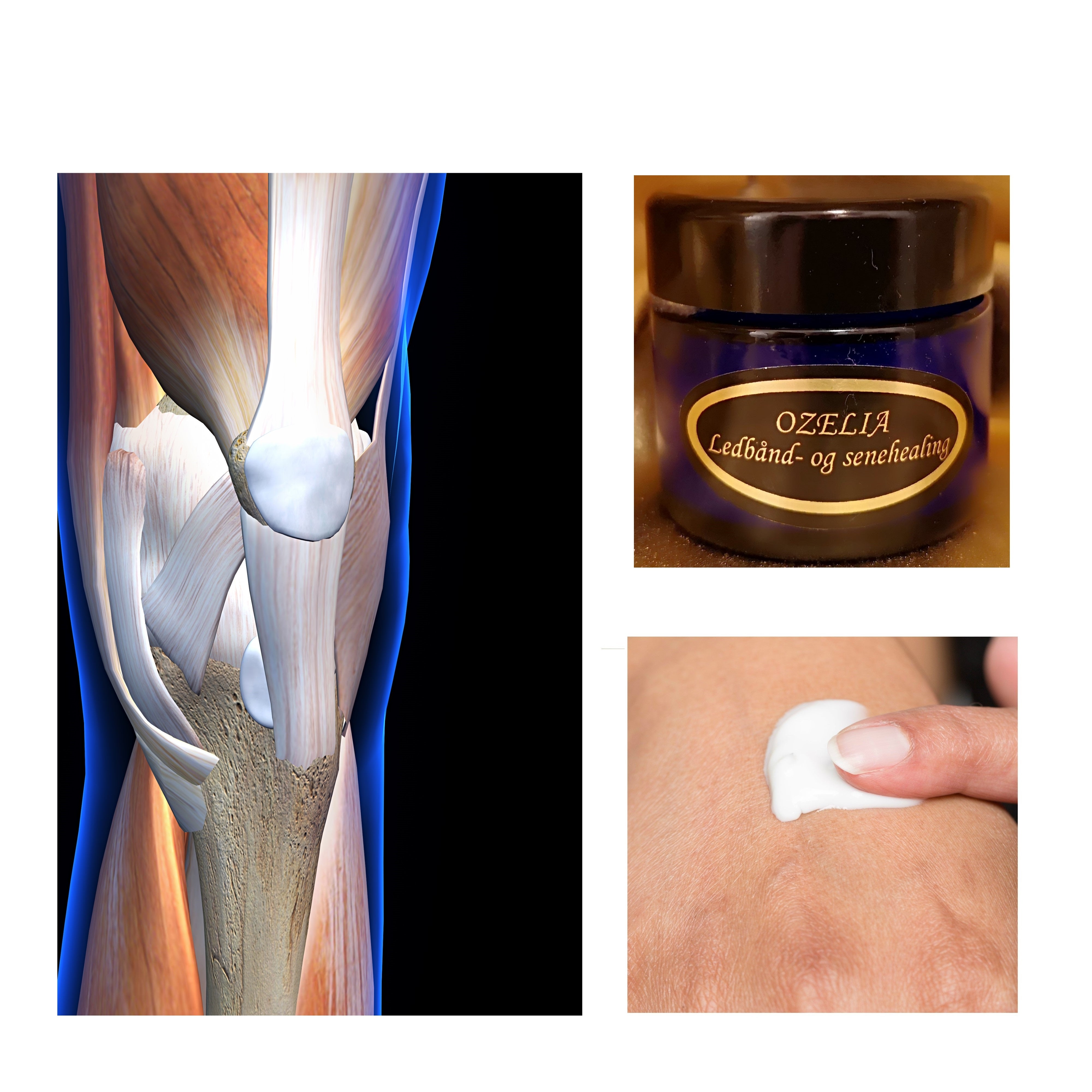 Ozelia Ligament- and Tendon Healing