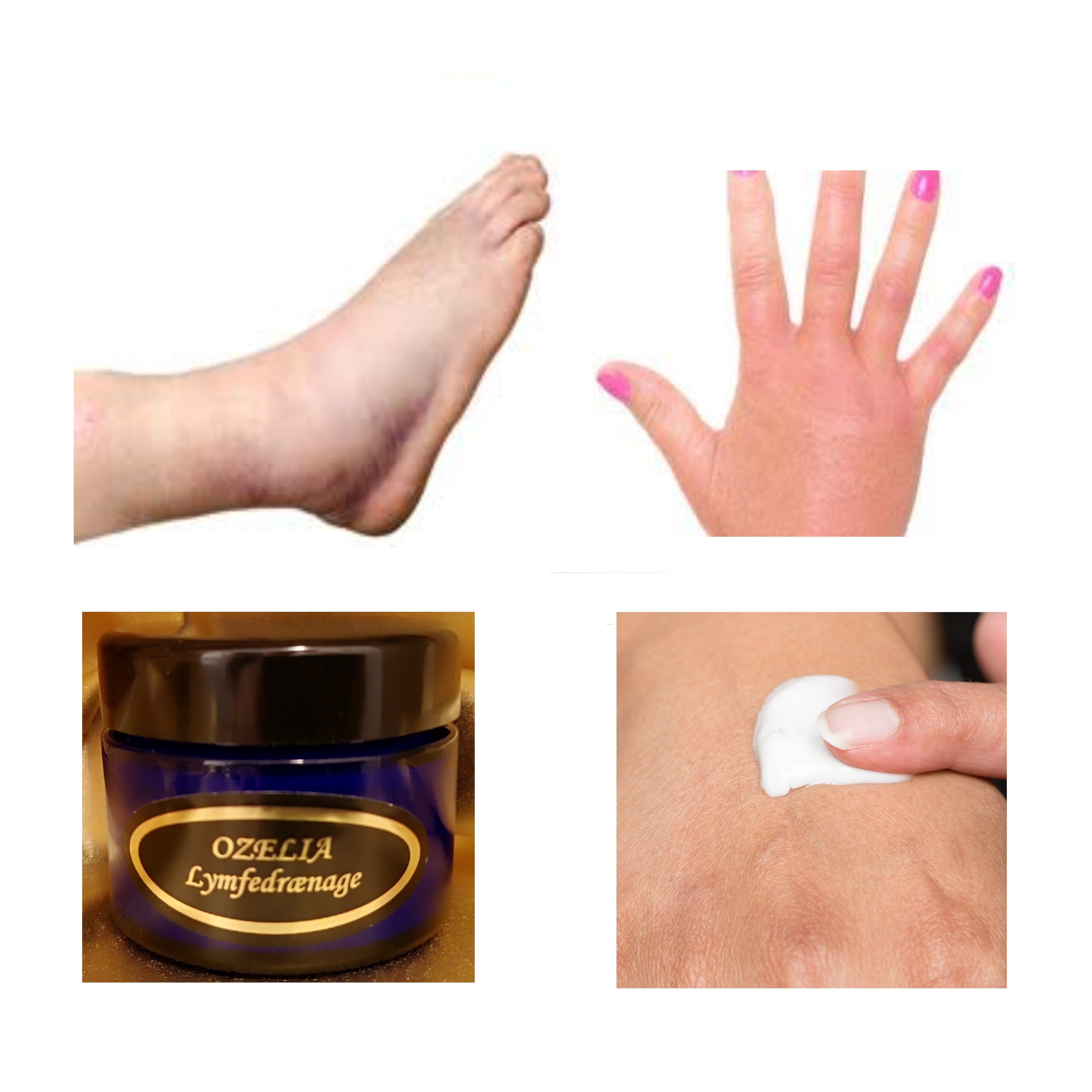 Ozelia Lymphatic Drainage
