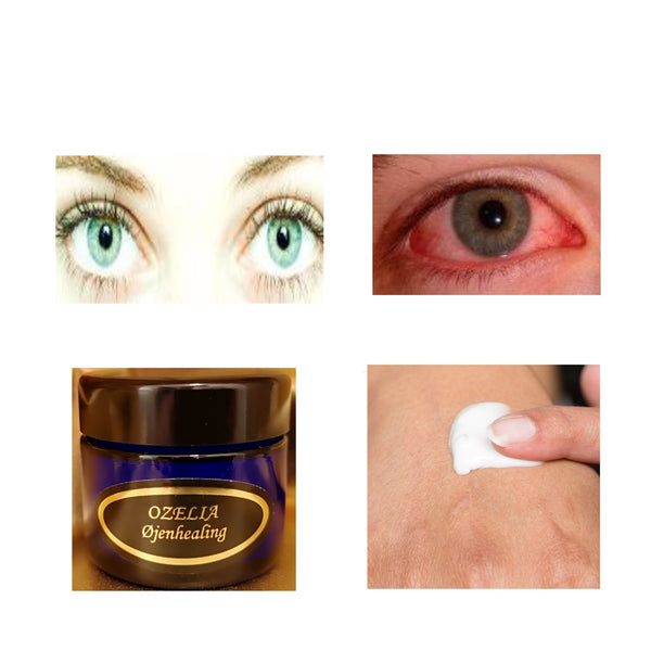 Ozelia Eye Healing