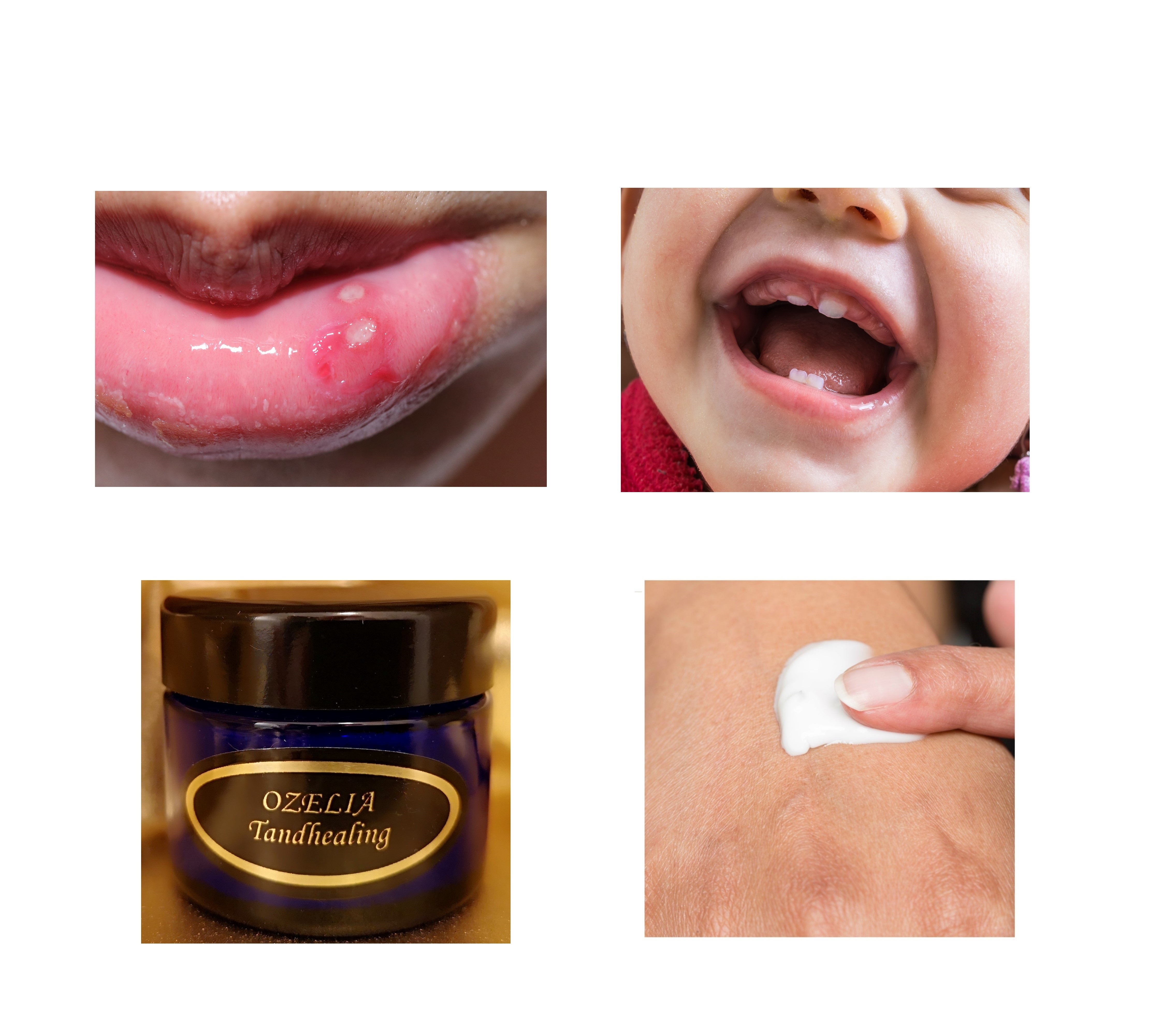 Ozelia Tooth Healing